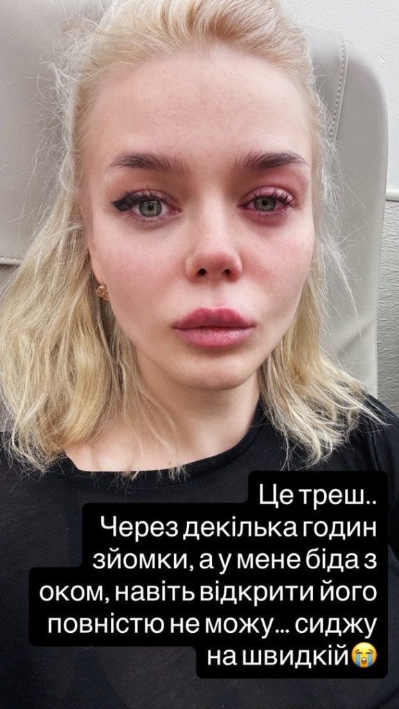 Аліна Гросу потрапила до лікарні: що сталося зі співачкою