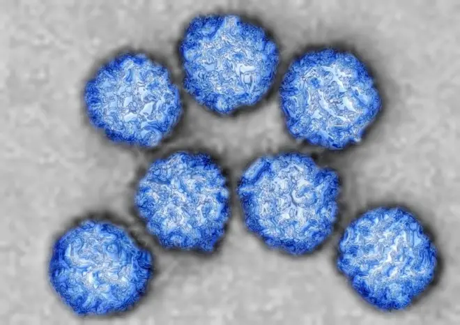 «Синій язик» у Європі: що це за вірус, симптоми у худоби, чи безпечно для людей і як захистити тварин «Синій язик» у Європі: що це за вірус і кому він загрожує