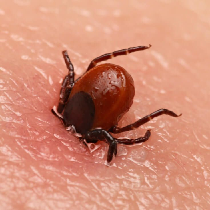Як безпечно видалити кліща та що робити після укусу